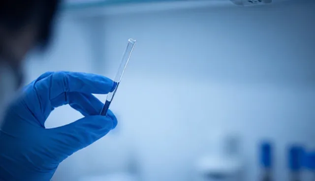 编辑标准流程优化中的适用情况与限制